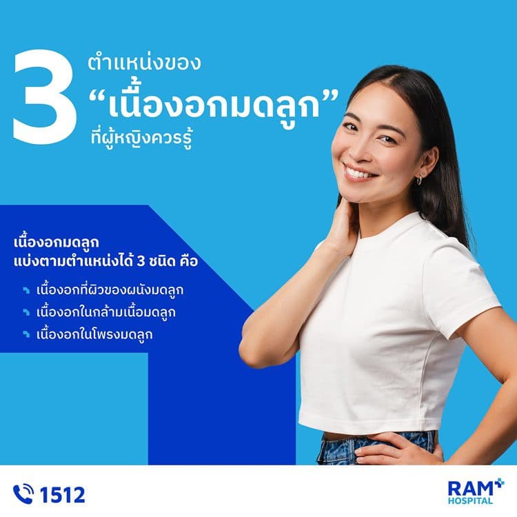 3 ตำแหน่งของ “เนื้องอกมดลูก” ที่ผู้หญิงควรรู้