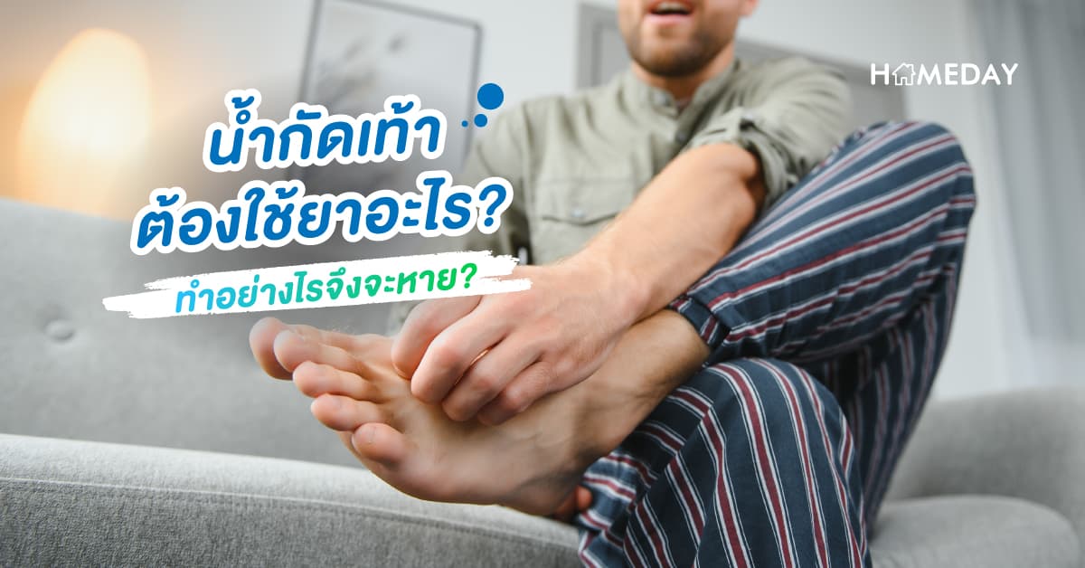 น้ำกัดเท้า ต้องใช้ยาอะไร? ทำอย่างไรจึงจะหาย?